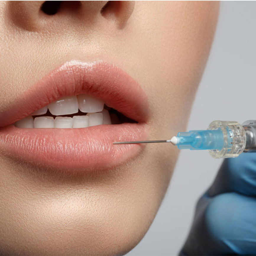 Young woman getting collagen procedure for mouth